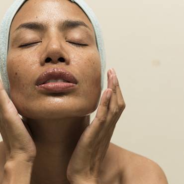 The Best Treatments for Oily Skin